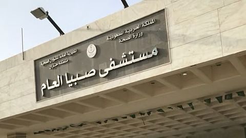 فريق طبي سعودي ينجح في تحرير التصاق كامل للسان مولودة خديج بمستشفى صبيا العام