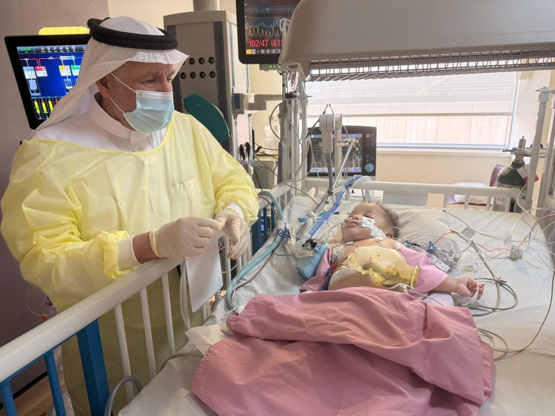 الدكتور الربيعة : استقرار حالة التوأم الصومالي "رحمة ورملا" بعد مرور أربعة أيام من عملية فصلهما الناجحة