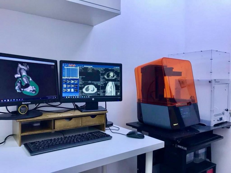 نجاح جراحات معقّدة لـ30 طفلًا بالطباعة ثلاثية الأبعاد بجامعة الملك عبدالعزيز