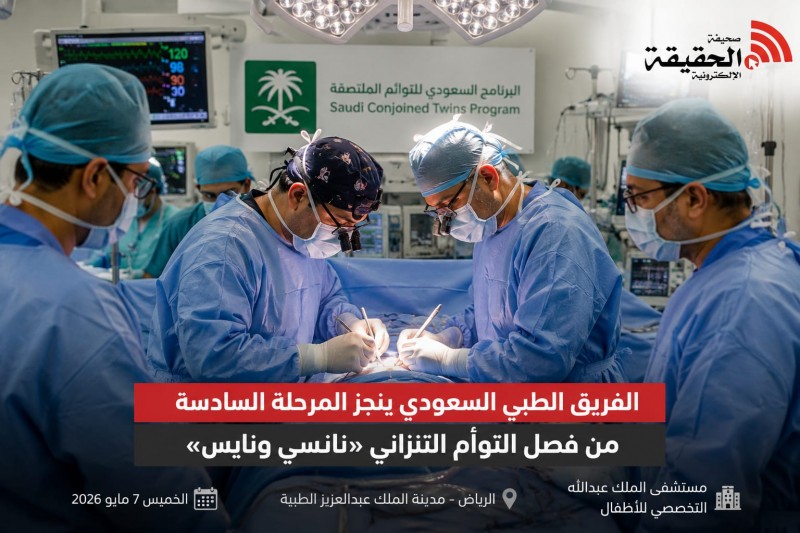الفريق الطبي ينجز المرحلة السادسة لفصل نانسي ونايس